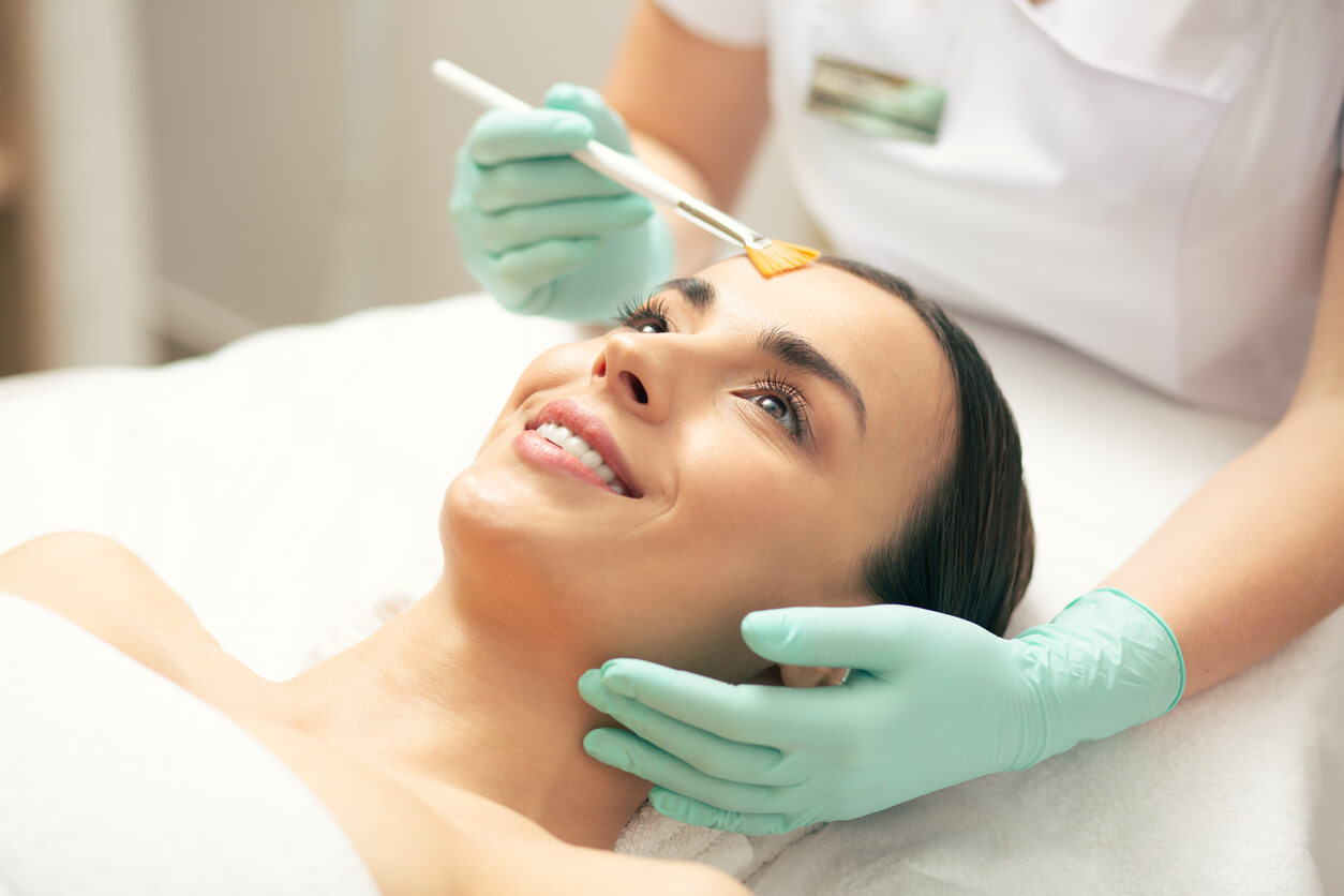 chemical peel treatments on the face