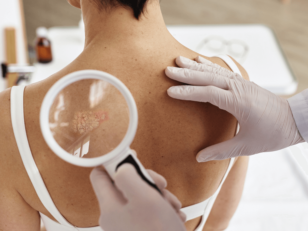 examining skin conditions on someone's back