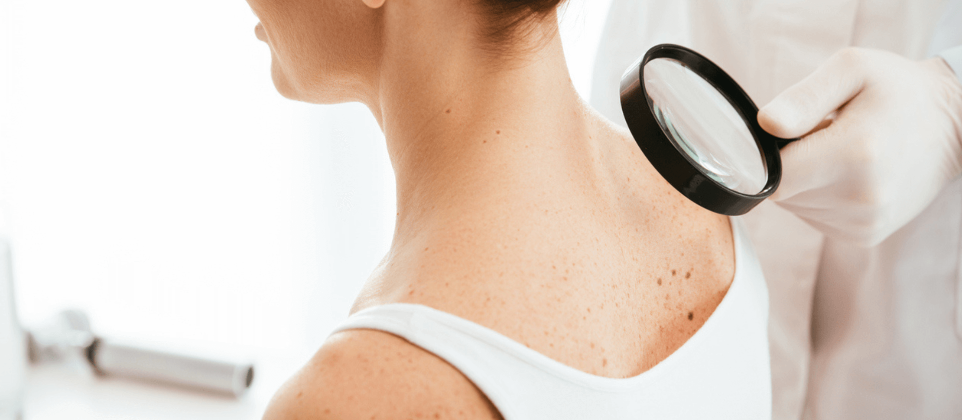 examining skin cancer on someone's back