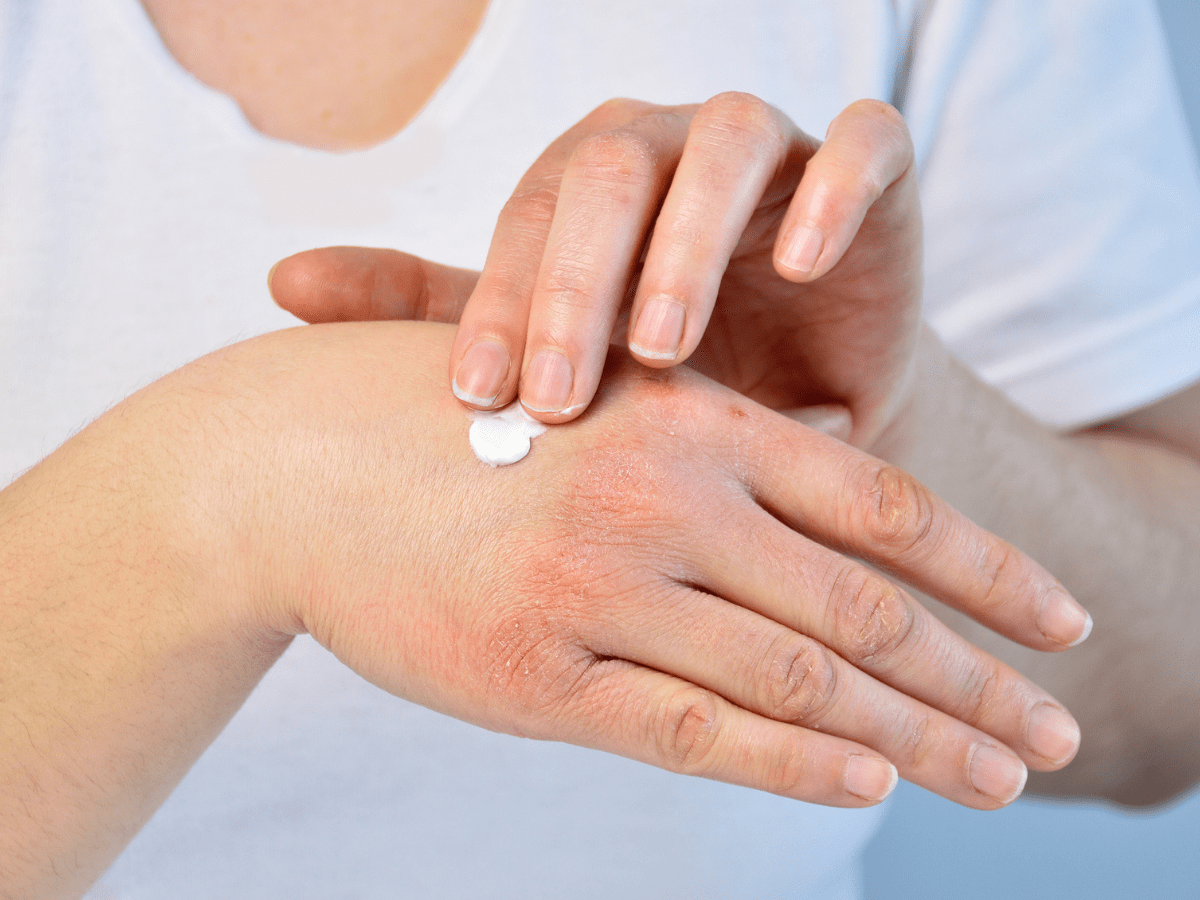 woman rubbing cream on her hand