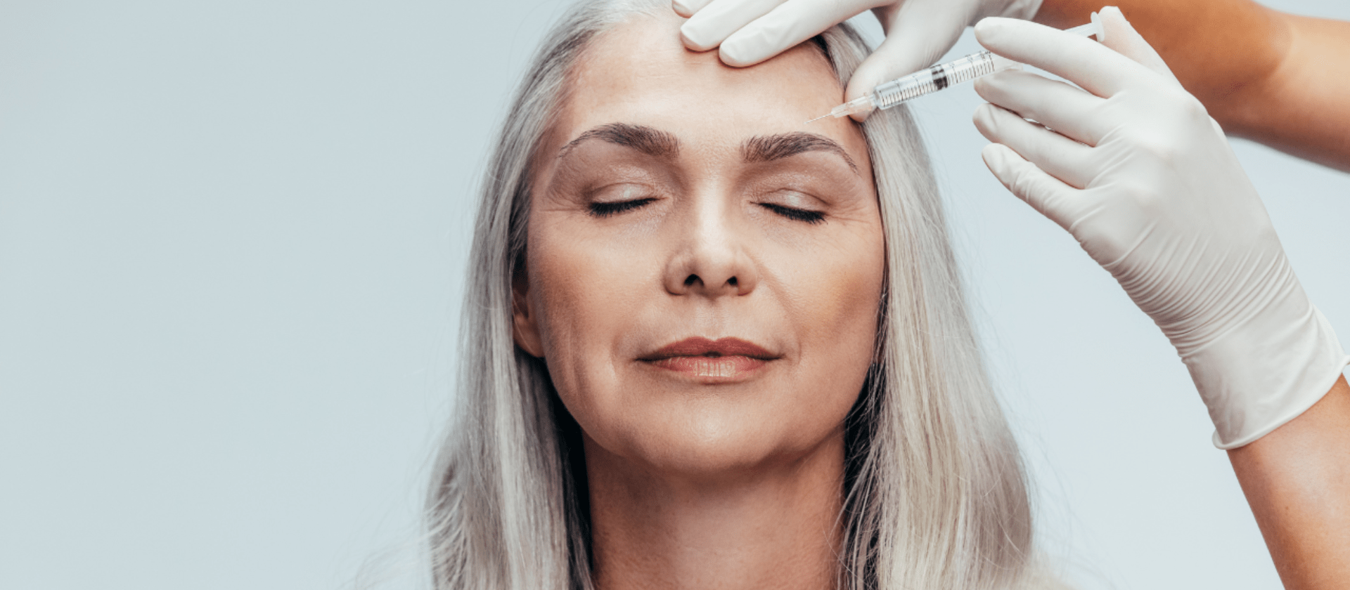 Dysport in the forehead